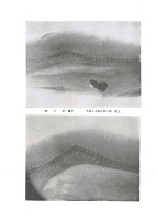 虹鱒「スコリオーゼ」のX線による観察