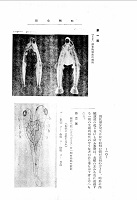 重複双生のサケ稚魚